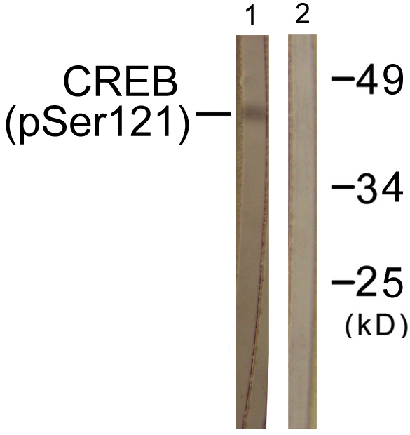 CREB1 / CREB Antibody - Western blot analysis of lysates from HeLa cells treated with Etoposide 25uM 24h, using CREB (Phospho-Ser121) Antibody. The lane on the right is blocked with the phospho peptide.