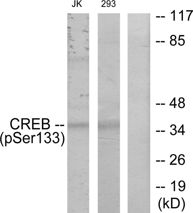 CREB1 / CREB Antibody - Western blot analysis of lysates from Jurkat and 293 cells treated with UV, using CREB (Phospho-Ser133) Antibody. The lane on the right is blocked with the phospho peptide.