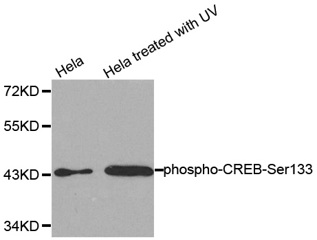 CREB1 / CREB Antibody - Western blot analysis of extracts from HeLa cells untreated or treated with UV.