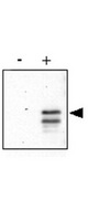 CREB1 / CREB Antibody - Anti-CREB pS133 Antibody - Western Blot. Anti-CREB pS133 was used to detect phosphorylated CREB by western blot. Recombinant His-tagged human CREB was produced in E. coli and purified by metal affinity chromatography. An aliquot of purified CREB was phosphorylated in-vitro using Protein Kinase A and ATP. western blot of control (-) and in-vitro phosphorylated CREB (+) was used to show that the antibody reacts specifically with the phosphorylated form. Pan reactive CREB (# LS-C19089) reacts equally with both non-phosphorylated and phosphorylated CREB (not shown). Detection occurs using a 1:500 dilution of antibody followed by 1:5000 dilution of HRP Goat-a-Rabbit IgG with visualization via ECL. Film exposure was approximately 1. Other detection systems will yield similar results. Personal Communication, Boss, J., Emory University School of Medicine, Atlanta, GA.