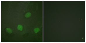 CREB1 / CREB Antibody - Immunofluorescence of HeLa cells, using CREB (Phospho-Ser142) Antibody. The sample on the right was incubated with synthetic peptide.