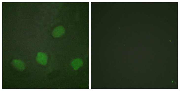 CREB1 / CREB Antibody - Immunofluorescence analysis of HeLa cells, using CREB (Phospho-Ser142) Antibody. The picture on the right is blocked with the phospho peptide.