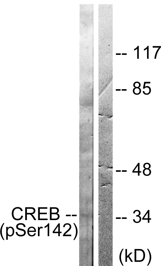 CREB1 / CREB Antibody - Western blot analysis of lysates from HeLa cells treated with PMA 125ng/ml 30', using CREB (Phospho-Ser142) Antibody. The lane on the right is blocked with the phospho peptide.