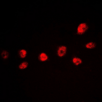 CREB1 / CREB Antibody - Immunofluorescent analysis of CREB (pS142) staining in HeLa cells. Formalin-fixed cells were permeabilized with 0.1% Triton X-100 in TBS for 5-10 minutes and blocked with 3% BSA-PBS for 30 minutes at room temperature. Cells were probed with the primary antibody in 3% BSA-PBS and incubated overnight at 4 ??C in a humidified chamber. Cells were washed with PBST and incubated with a DyLight 594-conjugated secondary antibody (red) in PBS at room temperature in the dark. DAPI was used to stain the cell nuclei (blue).