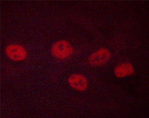 CREB1 / CREB Antibody - Staining SK-N-MC cells treated forskolin and FGF cells by IF/ICC. The samples were fixed with PFA and permeabilized in 0.1% saponin prior to blocking in 10% serum for 45 min at 37°C. The primary antibody was diluted 1/400 and incubated with the sample for 1 hour at 37°C. A Alexa Fluor® 594 conjugated goat polyclonal to rabbit IgG (H+L), diluted 1/600 was used as secondary antibody.
