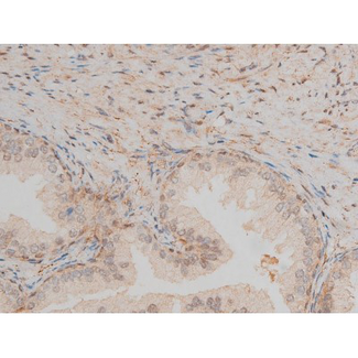 CREB1 / CREB Antibody - 1:200 staining human prostate tissue by IHC-P. The tissue was formaldehyde fixed and a heat mediated antigen retrieval step in citrate buffer was performed. The tissue was then blocked and incubated with the antibody for 1.5 hours at 22°C. An HRP conjugated goat anti-rabbit antibody was used as the secondary.