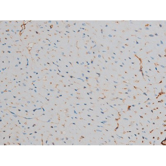 CREB1 / CREB Antibody - 1:200 staining mouse heart tissue by IHC-P. The tissue was formaldehyde fixed and a heat mediated antigen retrieval step in citrate buffer was performed. The tissue was then blocked and incubated with the antibody for 1.5 hours at 22°C. An HRP conjugated goat anti-rabbit antibody was used as the secondary.