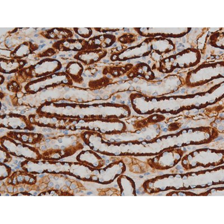 CREB1 / CREB Antibody - 1:200 staining rat kidney tissue by IHC-P. The tissue was formaldehyde fixed and a heat mediated antigen retrieval step in citrate buffer was performed. The tissue was then blocked and incubated with the antibody for 1.5 hours at 22°C. An HRP conjugated goat anti-rabbit antibody was used as the secondary.