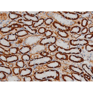 CREB1 / CREB Antibody - 1:200 staining rat kidney tissue by IHC-P. The tissue was formaldehyde fixed and a heat mediated antigen retrieval step in citrate buffer was performed. The tissue was then blocked and incubated with the antibody for 1.5 hours at 22°C. An HRP conjugated goat anti-rabbit antibody was used as the secondary.