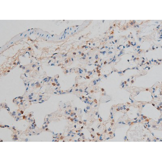 CREB1 / CREB Antibody - 1:200 staining rat lung tissue by IHC-P. The tissue was formaldehyde fixed and a heat mediated antigen retrieval step in citrate buffer was performed. The tissue was then blocked and incubated with the antibody for 1.5 hours at 22°C. An HRP conjugated goat anti-rabbit antibody was used as the secondary.