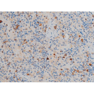 CREB1 / CREB Antibody - 1:200 staining rat spleen tissue by IHC-P. The tissue was formaldehyde fixed and a heat mediated antigen retrieval step in citrate buffer was performed. The tissue was then blocked and incubated with the antibody for 1.5 hours at 22°C. An HRP conjugated goat anti-rabbit antibody was used as the secondary.