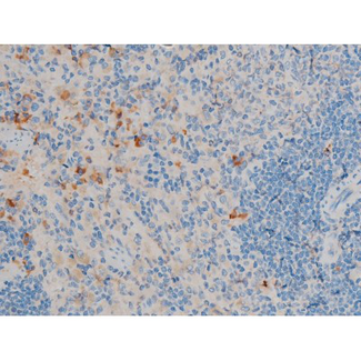 CREB1 / CREB Antibody - 1:200 staining rat spleen tissue by IHC-P. The tissue was formaldehyde fixed and a heat mediated antigen retrieval step in citrate buffer was performed. The tissue was then blocked and incubated with the antibody for 1.5 hours at 22°C. An HRP conjugated goat anti-rabbit antibody was used as the secondary.