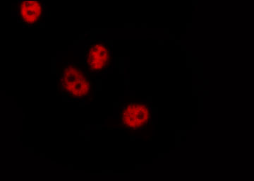 CREB1 / CREB Antibody - Staining HeLa cells by IF/ICC. The samples were fixed with PFA and permeabilized in 0.1% Triton X-100, then blocked in 10% serum for 45 min at 25°C. The primary antibody was diluted at 1:200 and incubated with the sample for 1 hour at 37°C. An Alexa Fluor 594 conjugated goat anti-rabbit IgG (H+L) Ab, diluted at 1/600, was used as the secondary antibody.