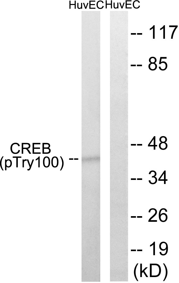 CREB1 / CREB Antibody - Western blot analysis of lysates from HUVEC cells treated with etoposide 25uM 24H, using CREB (Phospho-Thr100) Antibody. The lane on the right is blocked with the phospho peptide.