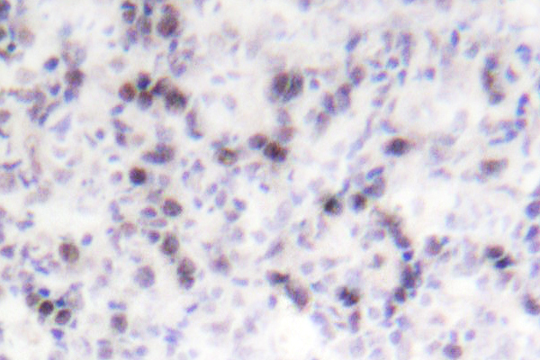 CREB1 / CREB Antibody - IHC of CREB (V115) pAb in paraffin-embedded human tonsil tissue.