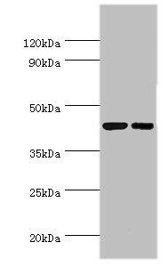 CREB3 / LZIP Antibody - Western blot All lanes: Cyclic AMP-responsive element-binding protein 3 antibody at 6µg/ml Lane 1: Jurkat whole cell lysate Lane 2: HepG2 whole cell lysate Secondary Goat polyclonal to rabbit IgG at 1/10000 dilution Predicted band size: 44, 42, 40 kDa Observed band size: 44 kDa