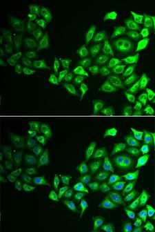 CREB3 / LZIP Antibody - Immunofluorescence analysis of HeLa cells.