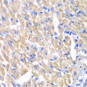 CREB3 / LZIP Antibody - Immunohistochemistry of paraffin-embedded Mouse heart using CREB3 Polyclonal Antibody at dilution of 1:100 (40x lens).