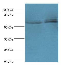 CREB3L2 / BBF2H7 Antibody - Western blot. All lanes: CREB3L2 antibody at 6 ug/ml. Lane 1: mouse liver tissue. Lane 2: mouse lung tissue. Secondary antibody: Goat polyclonal to rabbit at 1:10000 dilution. Predicted band size: 57 kDa. Observed band size: 57 kDa.
