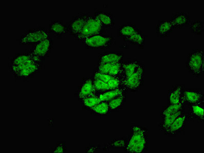 CREB3L2 / BBF2H7 Antibody - Immunofluorescent analysis of HepG2 cells using CREB3L2 Antibody at dilution of 1:100 and Alexa Fluor 488-congugated AffiniPure Goat Anti-Rabbit IgG(H+L)
