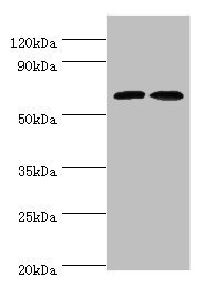 CREB3L2 / BBF2H7 Antibody - Western blot All lanes: CREB3L2 antibody at 6µg/ml Lane 1: Mouse liver tissue Lane 2: Mouse lung tissue Secondary Goat polyclonal to rabbit IgG at 1/10000 dilution Predicted band size: 58, 51, 28 kDa Observed band size: 58 kDa