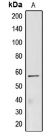 CREB3L2 / BBF2H7 Antibody - Western blot analysis of CREB3L2 expression in Jurkat (A) whole cell lysates.