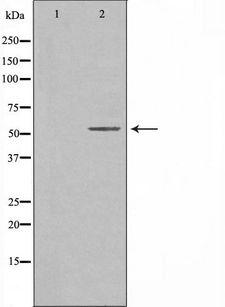 CREB3L2 / BBF2H7 Antibody - Western blot analysis of extracts of HeLa cells using CREB3L2 antibody. The lane on the left is treated with the antigen-specific peptide.