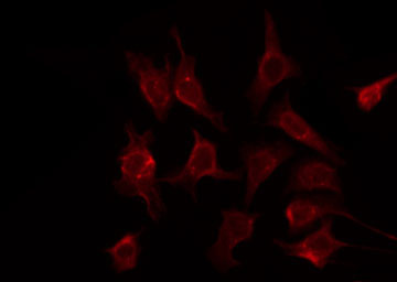 CREB3L2 / BBF2H7 Antibody - Staining HeLa cells by IF/ICC. The samples were fixed with PFA and permeabilized in 0.1% Triton X-100, then blocked in 10% serum for 45 min at 25°C. The primary antibody was diluted at 1:200 and incubated with the sample for 1 hour at 37°C. An Alexa Fluor 594 conjugated goat anti-rabbit IgG (H+L) Ab, diluted at 1/600, was used as the secondary antibody.