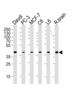 CREB3L4 / AIBZIP Antibody - CREB3L4 Antibody (M01) western blot of Daudi, PC-3, MCF-7, rat C6 and L6 cell line , rat brain tissue lysates (35 ug/lane). The CREB3L4 (M01)antibody detected the CREB3L4 (M01)protein (arrow).