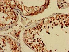 CREB3L4 / AIBZIP Antibody - Immunohistochemistry of paraffin-embedded human testis tissue at dilution of 1:100