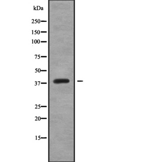 CREB3L4 / AIBZIP Antibody - Western blot analysis of CREB3L4 using K562 whole cells lysates