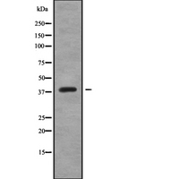 CREB3L4 / AIBZIP Antibody - Western blot analysis of CREB3L4 using K562 whole cells lysates