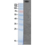 CREBBP / CREB Binding Protein Antibody - Western blot of Acetyl-CBP (K1535) antibody