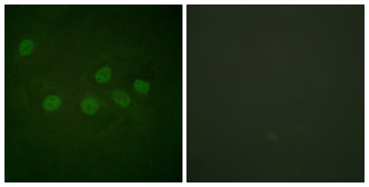 CREBBP / CREB Binding Protein Antibody - Immunofluorescence analysis of HeLa cells, using CBP Antibody. The picture on the right is blocked with the synthesized peptide.