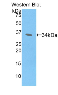 CREBBP / CREB Binding Protein Antibody - Western blot of recombinant CREBBP / CBP.  This image was taken for the unconjugated form of this product. Other forms have not been tested.