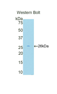 CREBBP / CREB Binding Protein Antibody - Western blot of recombinant CREBBP / CBP.  This image was taken for the unconjugated form of this product. Other forms have not been tested.