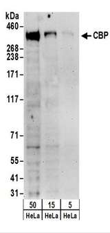 CREBBP / CREB Binding Protein Antibody - Detection of Human CBP by Western Blot. Samples: Whole cell lysate (5, 15 and 50 ug) from HeLa cells. Antibodies: Affinity purified rabbit anti-CBP antibody used for WB at 0.4 ug/ml. Detection: Chemiluminescence with an exposure time of 3 minutes.