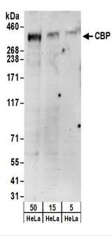 CREBBP / CREB Binding Protein Antibody - Detection of Human CBP by Western Blot. Samples: Whole cell lysate (5, 15 and 50 ug) from HeLa cells. Antibodies: Affinity purified rabbit anti-CBP antibody used for WB at 0.4 ug/ml. Detection: Chemiluminescence with an exposure time of 3 minutes.
