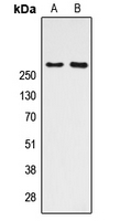 CREBBP / CREB Binding Protein Antibody - Western blot analysis of CBP (AcK1535) expression in HeLa (A); NIH3T3 (B) whole cell lysates.