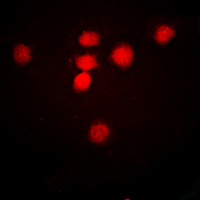 CREBBP / CREB Binding Protein Antibody - Immunofluorescent analysis of CBP (AcK1535) staining in HeLa cells. Formalin-fixed cells were permeabilized with 0.1% Triton X-100 in TBS for 5-10 minutes and blocked with 3% BSA-PBS for 30 minutes at room temperature. Cells were probed with the primary antibody in 3% BSA-PBS and incubated overnight at 4 deg C in a humidified chamber. Cells were washed with PBST and incubated with a DyLight 594-conjugated secondary antibody (red) in PBS at room temperature in the dark. DAPI was used to stain the cell nuclei (blue).