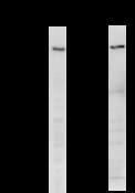 CREBBP / CREB Binding Protein Antibody - Detection of CBP by Western blot. Samples: Whole cell lysate from human HeLa (H, 50 ug) and mouse NIH3T3 (M, 50 ug) cells. Predicted molecular weight: 265 kDa