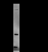 CREBBP / CREB Binding Protein Antibody - Immunoprecipitation: RIPA lysate of HeLa cells was incubated with anti-CBP mAb. Predicted molecular weight: 265 kDa
