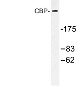 CREBBP / CREB Binding Protein Antibody - Western blot of CBP (E1528) pAb in extracts from HT-29 cells treated with calyculin A 50ng.