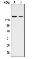 CREBBP / CREB Binding Protein Antibody - Western blot analysis of CBP expression in HeLa (A); NIH3T3 (B) whole cell lysates.