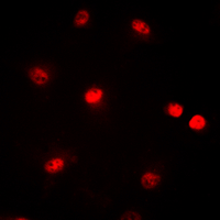 CREBBP / CREB Binding Protein Antibody - Immunofluorescent analysis of CBP staining in HeLa cells. Formalin-fixed cells were permeabilized with 0.1% Triton X-100 in TBS for 5-10 minutes and blocked with 3% BSA-PBS for 30 minutes at room temperature. Cells were probed with the primary antibody in 3% BSA-PBS and incubated overnight at 4 deg C in a humidified chamber. Cells were washed with PBST and incubated with a DyLight 594-conjugated secondary antibody (red) in PBS at room temperature in the dark. DAPI was used to stain the cell nuclei (blue).