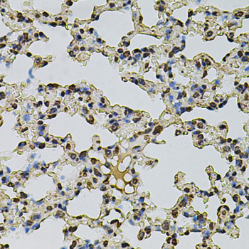 CREBBP / CREB Binding Protein Antibody - Immunohistochemistry of paraffin-embedded mouse lung using CREBBP antibodyat dilution of 1:100 (40x lens).