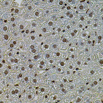CREBBP / CREB Binding Protein Antibody - Immunohistochemistry of paraffin-embedded mouse liver using CREBBP antibodyat dilution of 1:100 (40x lens).