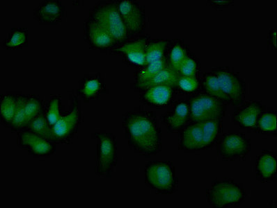 CREBBP / CREB Binding Protein Antibody - Immunofluorescent analysis of MCF-7 cells at a dilution of 1:100 and Alexa Fluor 488-congugated AffiniPure Goat Anti-Rabbit IgG(H+L)