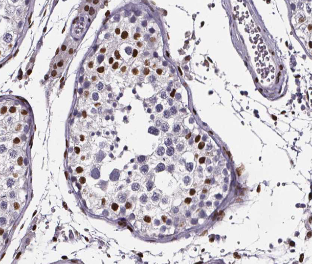 CREBBP / CREB Binding Protein Antibody - 1:200 staining human Testis tissue by IHC-P. The tissue was formaldehyde fixed and a heat mediated antigen retrieval step in citrate buffer was performed. The tissue was then blocked and incubated with the antibody for 1.5 hours at 22°C. An HRP conjugated goat anti-rabbit antibody was used as the secondary.
