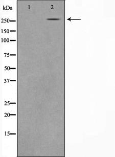 CREBBP / CREB Binding Protein Antibody - Western blot analysis on HeLa cell lysates using CREB-BP antibody. The lane on the left is treated with the antigen-specific peptide.